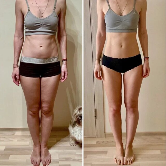 PelviFit™ – Entraîneur Pelvien pour Jambes Fermes